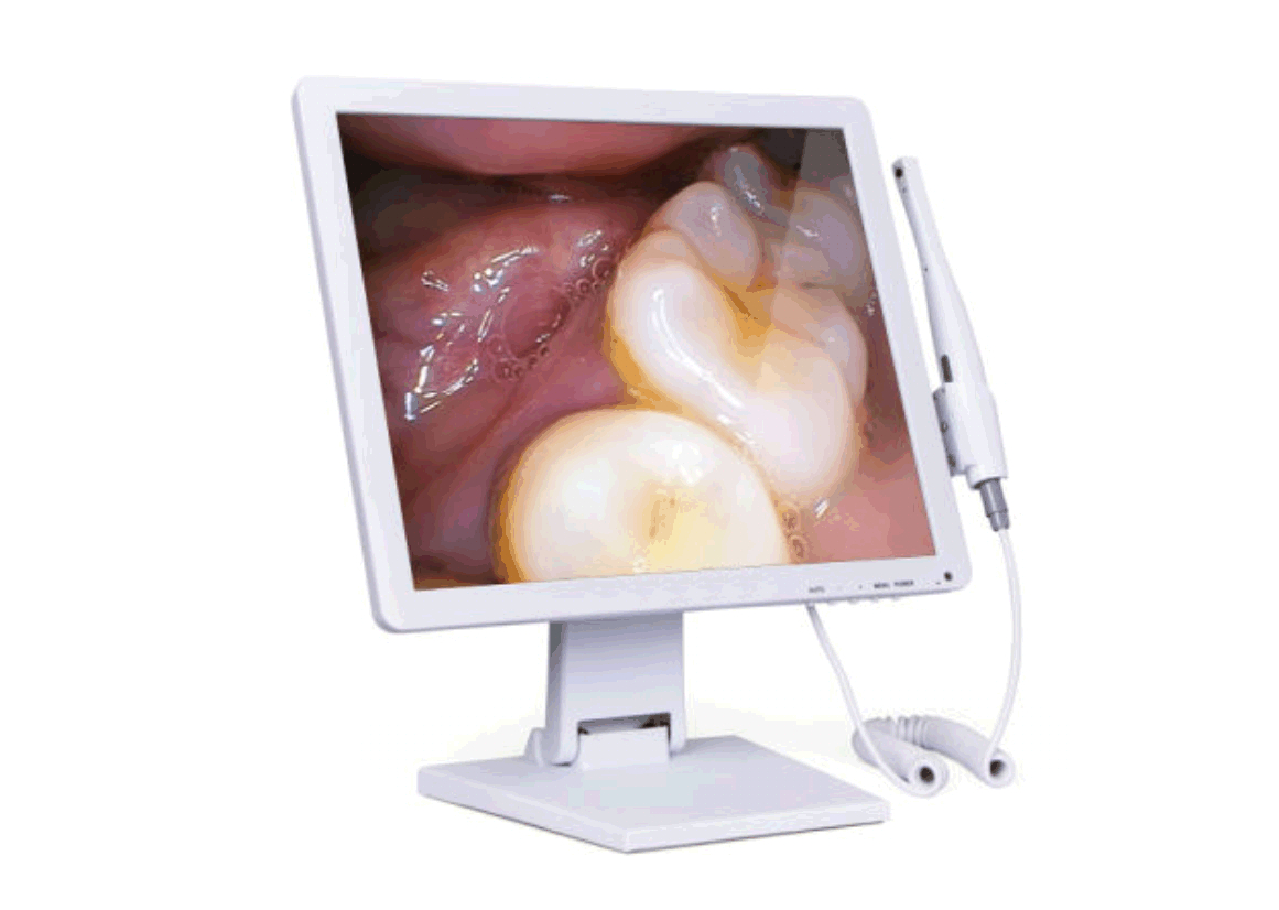 Intra-oral Camera
